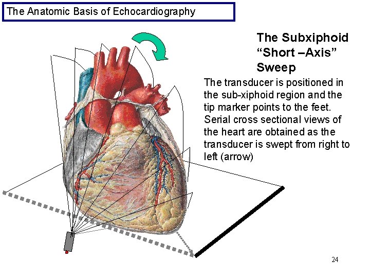 The Anatomic Basis of Echocardiography The Subxiphoid “Short –Axis” Sweep The transducer is positioned