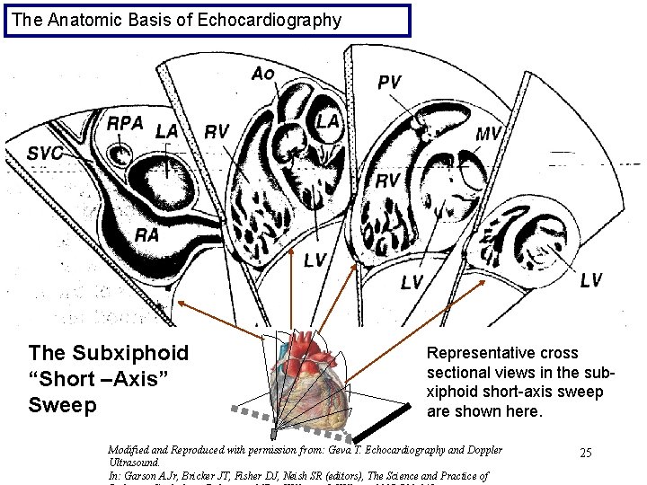 The Anatomic Basis of Echocardiography The Subxiphoid “Short –Axis” Sweep Representative cross sectional views