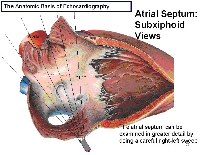 The Anatomic Basis of Echocardiography Aorta Atrial Septum: Subxiphoid Views The atrial septum can
