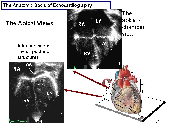 The Anatomic Basis of Echocardiography The Apical Views Inferior sweeps reveal posterior structures RA