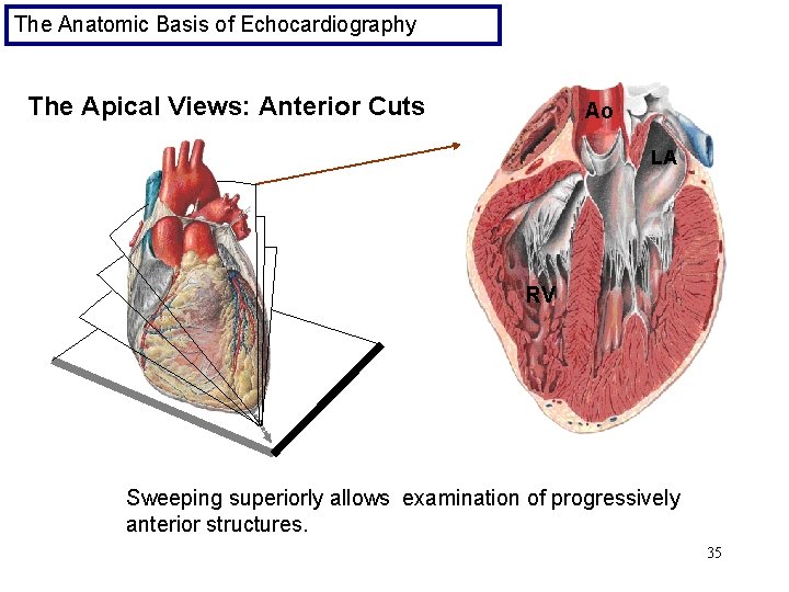 The Anatomic Basis of Echocardiography The Apical Views: Anterior Cuts Ao LA RV Sweeping