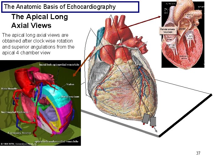 The Anatomic Basis of Echocardiography The Apical Long Axial Views The apical long axial