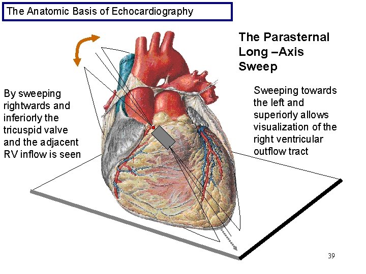 The Anatomic Basis of Echocardiography The Parasternal Long –Axis Sweep By sweeping rightwards and