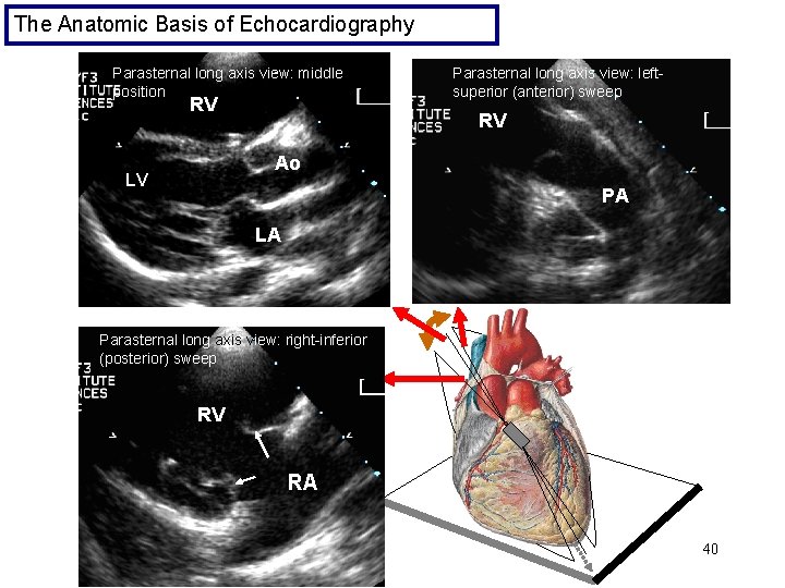 The Anatomic Basis of Echocardiography Parasternal long axis view: middle position RV Parasternal long