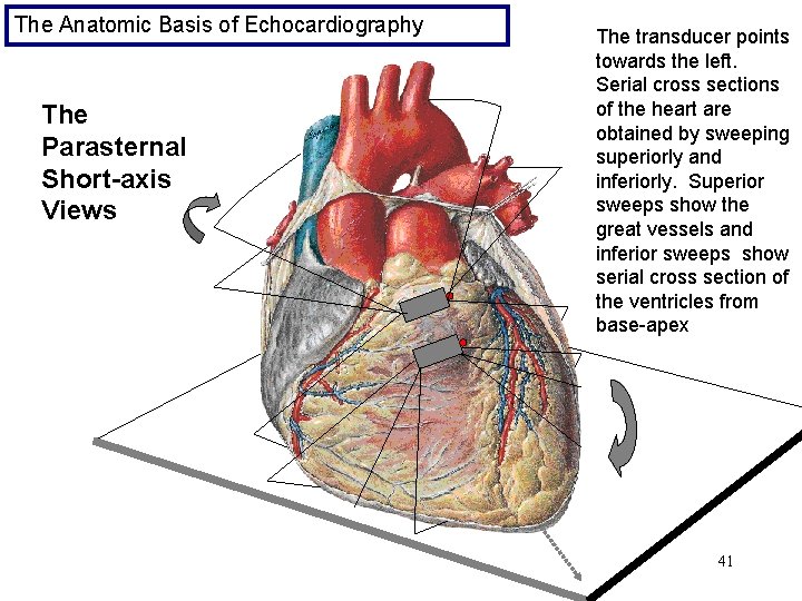 The Anatomic Basis of Echocardiography The Parasternal Short-axis Views The transducer points towards the