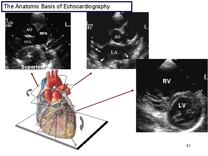 The Anatomic Basis of Echocardiography AO MPA AO LA A RPA A LP LA