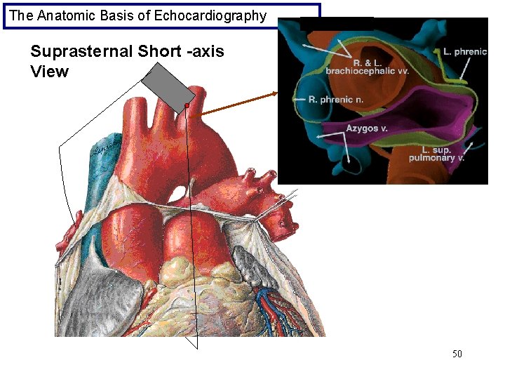 The Anatomic Basis of Echocardiography Suprasternal Short -axis View 50 