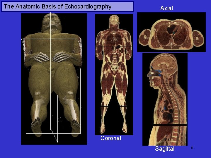 The Anatomic Basis of Echocardiography Axial Coronal Sagittal 6 