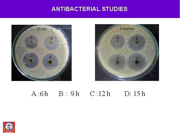 ANTIBACTERIAL STUDIES A : 6 h B: 9 h C : 12 h D: