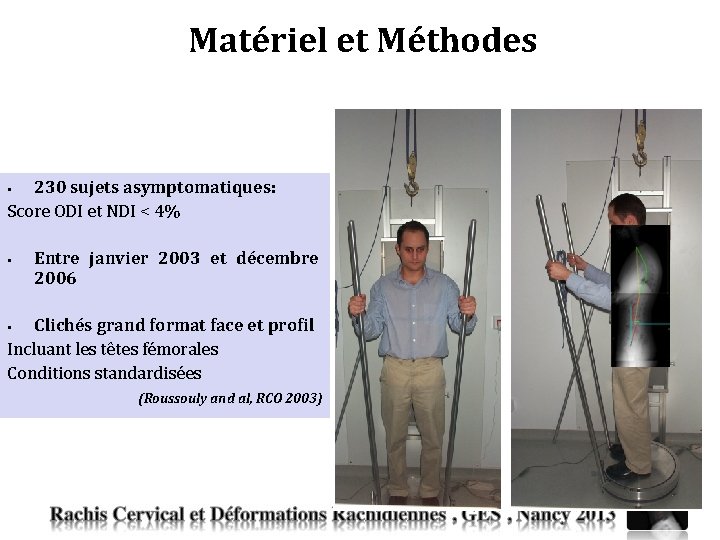Etude morphologique de la courbure cervicale infrieure dans