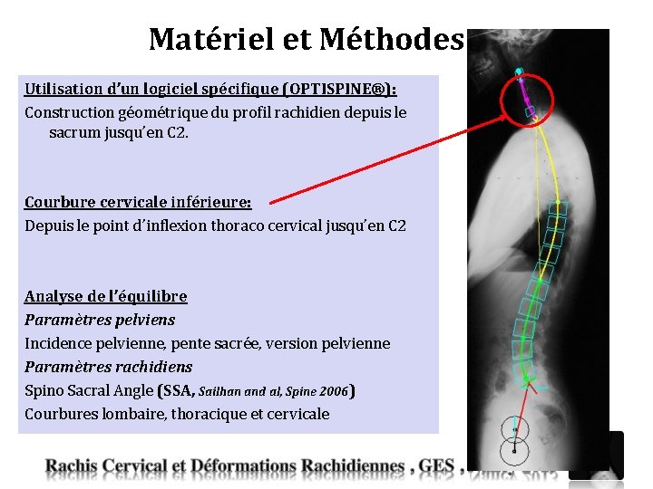 Etude morphologique de la courbure cervicale infrieure dans