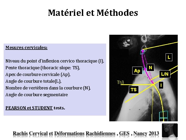 Etude morphologique de la courbure cervicale infrieure dans