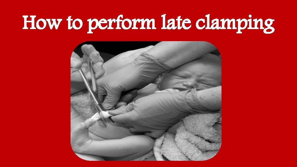 How to perform late clamping 