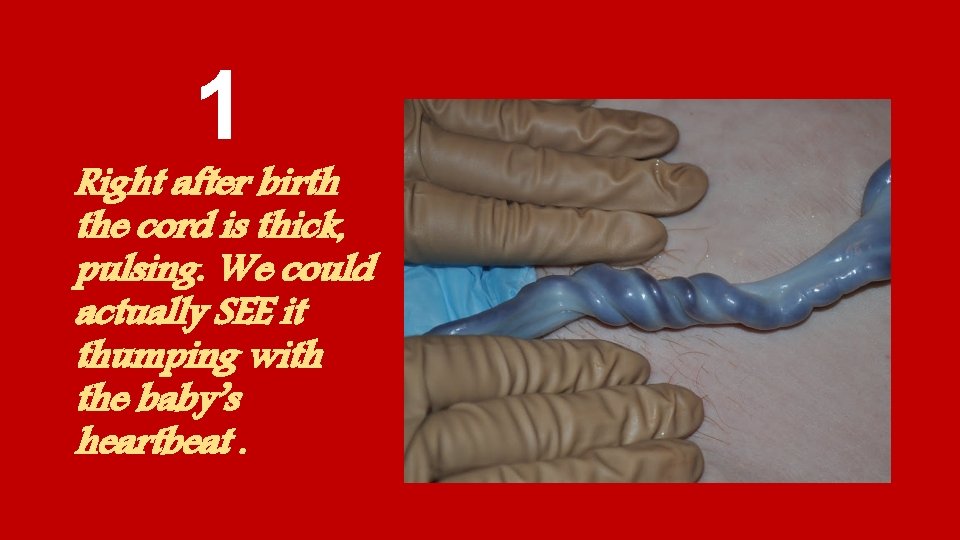 1 Right after birth the cord is thick, pulsing. We could actually SEE it