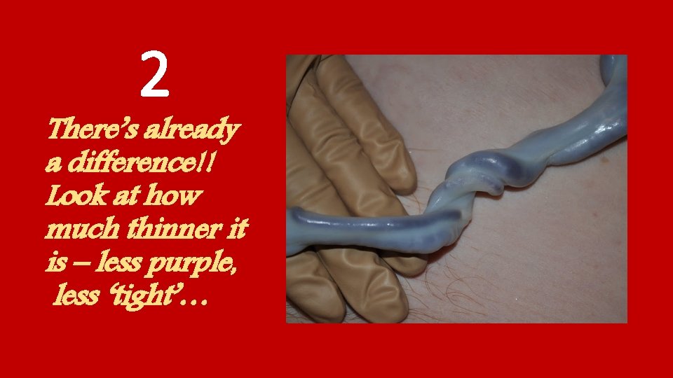 2 There’s already a difference!! Look at how much thinner it is – less