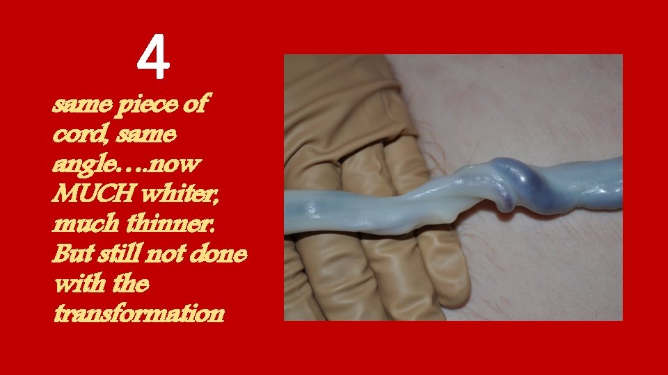 4 same piece of cord, same angle…. now MUCH whiter, much thinner. But still