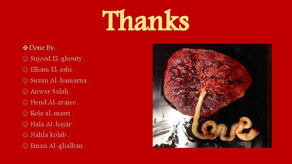 v. Done By: Sujood El-ghouty. Elham El-ashi. Suzan Al-hamarna. Anwar Salah. Hend Al-zraiee. Rola