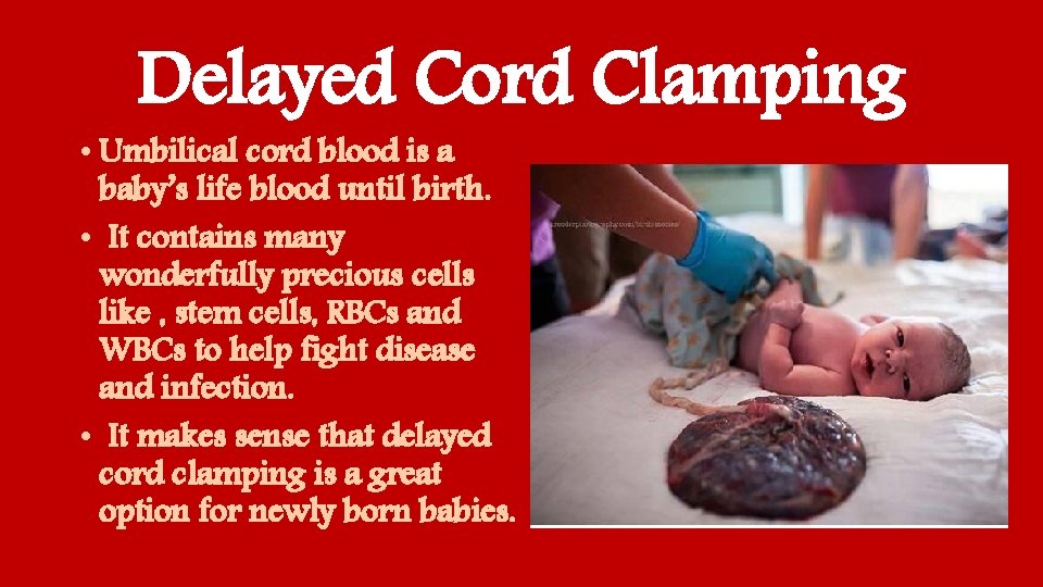 Delayed Cord Clamping • Umbilical cord blood is a baby’s life blood until birth.