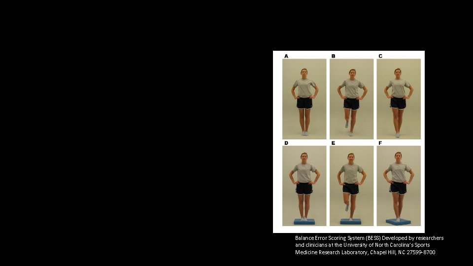 Balance Error Scoring System (BESS) Developed by researchers and clinicians at the University of