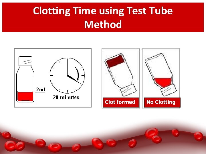 Clotting Time using Test Tube Method Clot formed No Clotting 