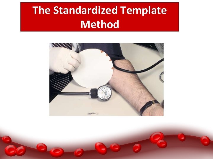 The Standardized Template Method 