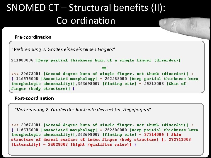 SNOMED CT – Structural benefits (II): Co-ordination Pre-coordination "Verbrennung 2. Grades einzelnen Fingers" 211908006