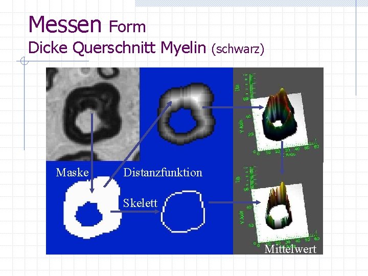 Messen Form Dicke Querschnitt Myelin Maske (schwarz) Distanzfunktion Skelett Mittelwert 