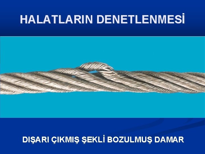 HALATLARIN DENETLENMESİ DIŞARI ÇIKMIŞ ŞEKLİ BOZULMUŞ DAMAR 