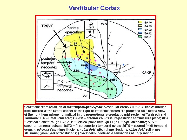 Vestibular Cortex Schematic representation of the temporo-peri-Sylvian vestibular cortex (TPSVC). The vestibular sites located