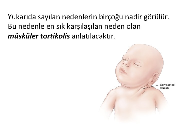 Yukarıda sayılan nedenlerin birçoğu nadir görülür. Bu nedenle en sık karşılan neden olan müsküler