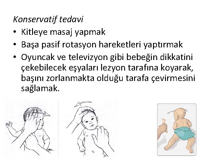 Konservatif tedavi • Kitleye masaj yapmak • Başa pasif rotasyon hareketleri yaptırmak • Oyuncak