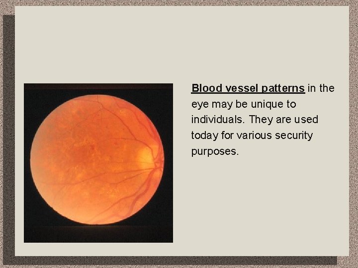 Blood vessel patterns in the eye may be unique to individuals. They are used