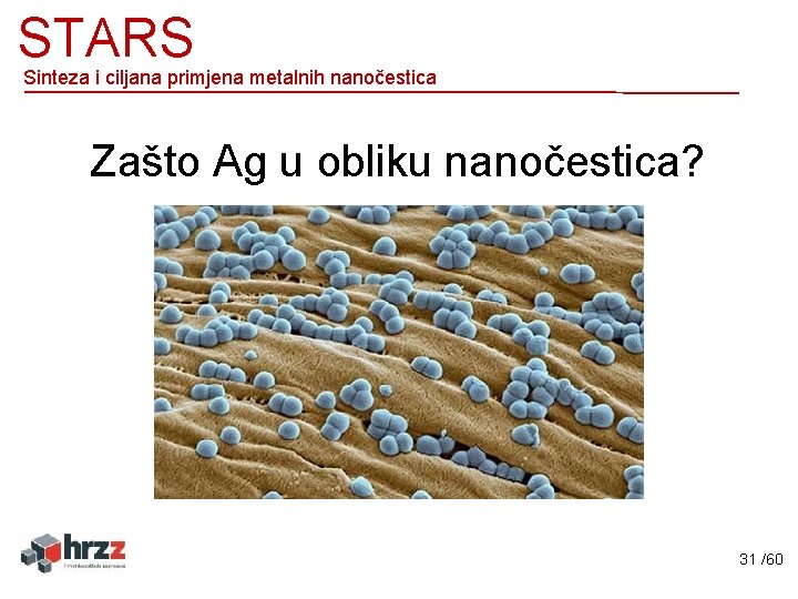 STARS Sinteza i ciljana primjena metalnih nanočestica Zašto Ag u obliku nanočestica? 31 /60