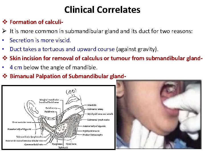 Clinical Correlates v Ø • • v Formation of calculi. It is more common