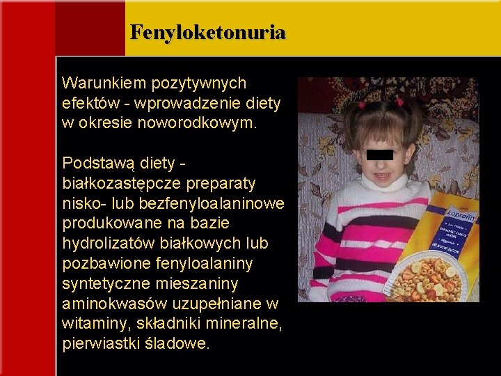 Fenyloketonuria Warunkiem pozytywnych efektów - wprowadzenie diety w okresie noworodkowym. Podstawą diety białkozastępcze preparaty