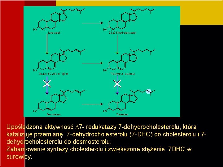 Upośledzona aktywność 7 - redukatazy 7 -dehydrocholesterolu, która katalizuje przemianę 7 -dehydrocholesterolu (7 -DHC)