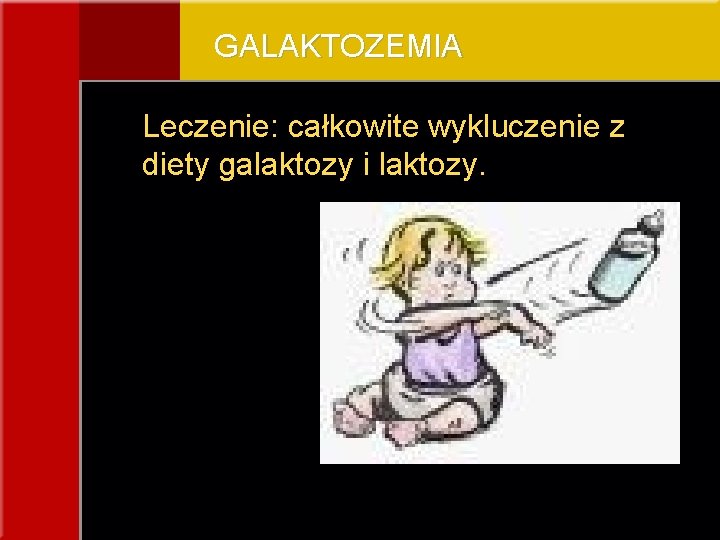 GALAKTOZEMIA Leczenie: całkowite wykluczenie z diety galaktozy i laktozy. 