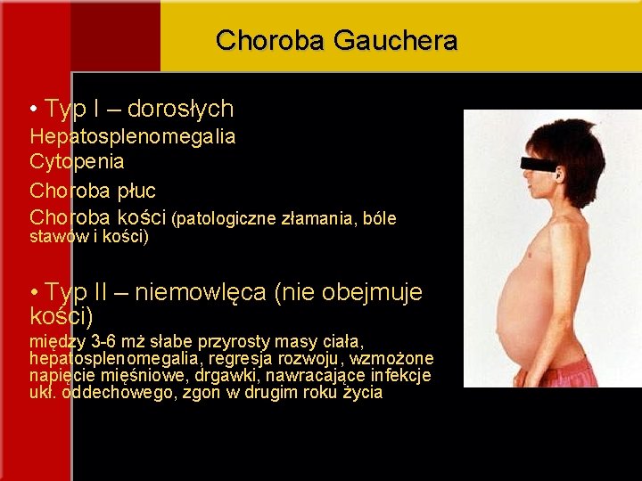 Choroba Gauchera • Typ I – dorosłych Hepatosplenomegalia Cytopenia Choroba płuc Choroba kości (patologiczne