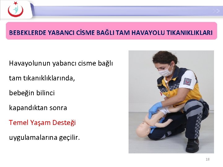 BEBEKLERDE YABANCI CİSME BAĞLI TAM HAVAYOLU TIKANIKLIKLARI Havayolunun yabancı cisme bağlı tam tıkanıklıklarında, bebeğin