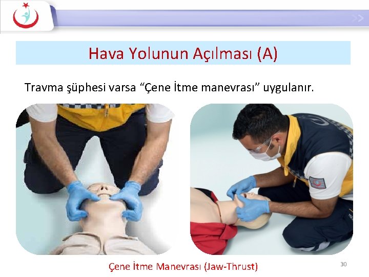 Hava Yolunun Açılması (A) Travma şüphesi varsa “Çene İtme manevrası” uygulanır. Çene İtme Manevrası