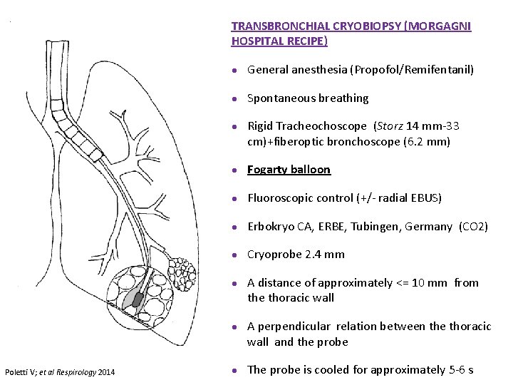 TRANSBRONCHIAL CRYOBIOPSY (MORGAGNI HOSPITAL RECIPE) Poletti V; et al Respirology 2014 ● General anesthesia