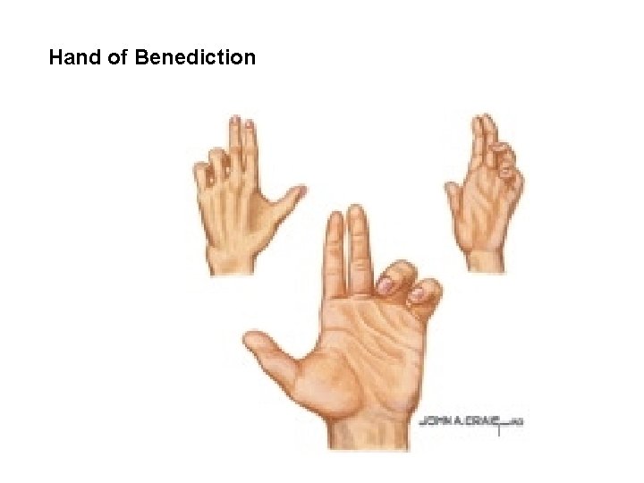 Hand of Benediction 