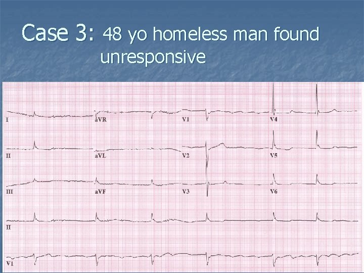 Case 3: 48 yo homeless man found unresponsive 