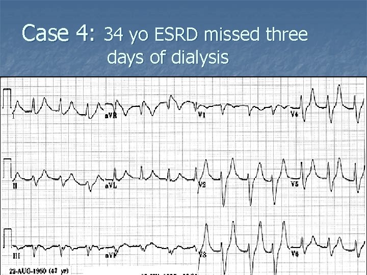 Case 4: 34 yo ESRD missed three days of dialysis 