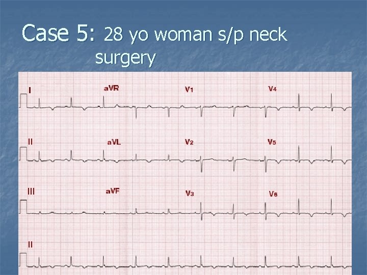 Case 5: 28 yo woman s/p neck surgery 