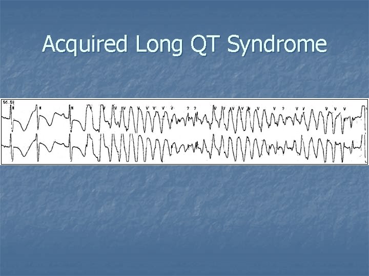 Acquired Long QT Syndrome 