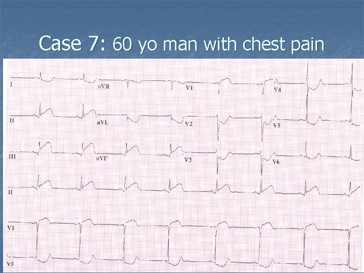 Case 7: 60 yo man with chest pain 