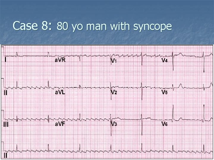 Case 8: 80 yo man with syncope 