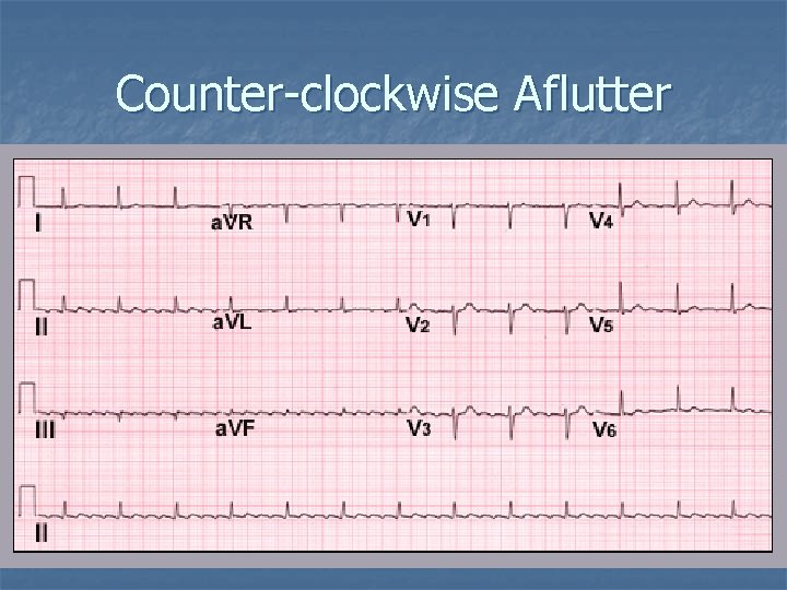 Counter-clockwise Aflutter 