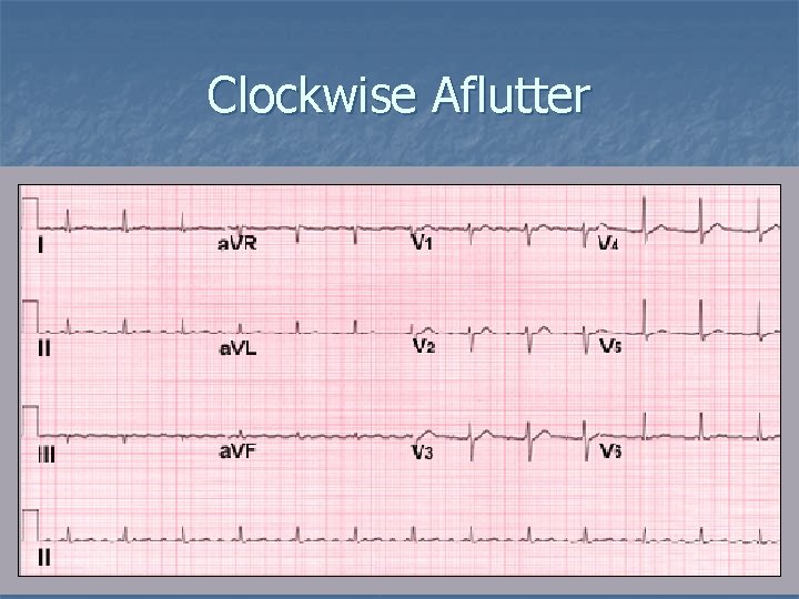 Clockwise Aflutter 